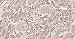 LAMP1 Antibody in Immunohistochemistry (Paraffin) (IHC (P))