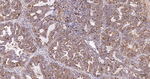 LAMP1 Antibody in Immunohistochemistry (Paraffin) (IHC (P))