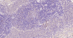 Beclin 1 Antibody in Immunohistochemistry (Paraffin) (IHC (P))