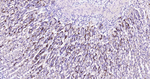 Beclin 1 Antibody in Immunohistochemistry (Paraffin) (IHC (P))