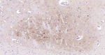 Beclin 1 Antibody in Immunohistochemistry (Paraffin) (IHC (P))