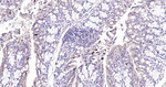 Beclin 1 Antibody in Immunohistochemistry (Paraffin) (IHC (P))
