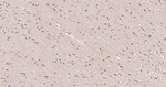Beclin 1 Antibody in Immunohistochemistry (Paraffin) (IHC (P))