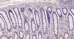 Beclin 1 Antibody in Immunohistochemistry (Paraffin) (IHC (P))