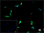 Procalcitonin Monoclonal Antibody (2F2-B4)