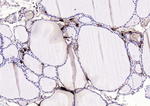 Procalcitonin Antibody in Immunohistochemistry (Paraffin) (IHC (P))