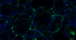 Procalcitonin Antibody in Immunohistochemistry (Paraffin) (IHC (P))