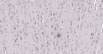 beta Amyloid (1-42) Antibody in Immunohistochemistry (Paraffin) (IHC (P))