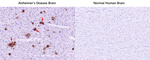 beta Amyloid (1-42) Antibody in Immunohistochemistry (Paraffin) (IHC (P))