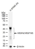 VEGF-165 Monoclonal Antibody (19D2)