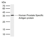 PSA Antibody in Western Blot (WB)