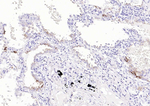 MUC1 Monoclonal Antibody (5B9)