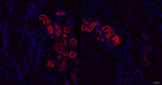 MUC1 Antibody in Immunohistochemistry (Paraffin) (IHC (P))