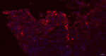 MUC1 Antibody in Immunohistochemistry (Paraffin) (IHC (P))
