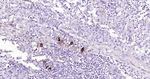 MUC1 Antibody in Immunohistochemistry (Paraffin) (IHC (P))