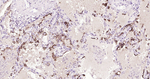 MUC1 Antibody in Immunohistochemistry (Paraffin) (IHC (P))