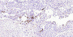 MUC1 Antibody in Immunohistochemistry (Paraffin) (IHC (P))
