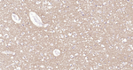 Tau (isoform 4) Antibody in Immunohistochemistry (Paraffin) (IHC (P))