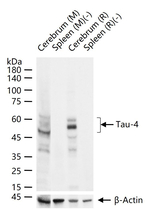 Tau (isoform 4) Antibody in Western Blot (WB)
