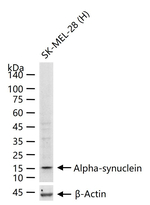 alpha Synuclein Antibody in Western Blot (WB)