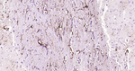 GFAP Antibody in Immunohistochemistry (Paraffin) (IHC (P))