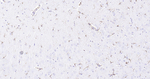 GFAP Monoclonal Antibody (8H10)
