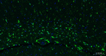 GFAP Antibody in Immunohistochemistry (Paraffin) (IHC (P))