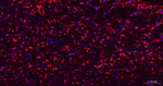 GFAP Antibody in Immunohistochemistry (Paraffin) (IHC (P))