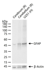 GFAP Antibody in Western Blot (WB)