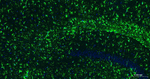 GFAP Antibody in Immunohistochemistry (Paraffin) (IHC (P))