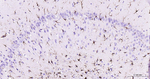 GFAP Antibody in Immunohistochemistry (Paraffin) (IHC (P))
