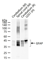 GFAP Antibody in Western Blot (WB)