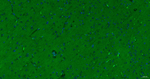 alpha Synuclein Antibody in Immunohistochemistry (Paraffin) (IHC (P))