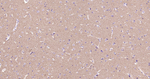 alpha Synuclein Antibody in Immunohistochemistry (Paraffin) (IHC (P))