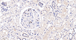 ZO-1 Antibody in Immunohistochemistry (Paraffin) (IHC (P))