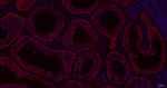 MYO7A Recombinant Rabbit Monoclonal Antibody (10H4)