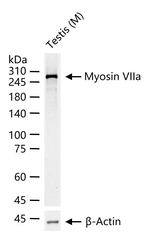 MYO7A Antibody in Western Blot (WB)