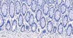TIMP1 Antibody in Immunohistochemistry (Paraffin) (IHC (P))