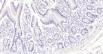 TIMP1 Antibody in Immunohistochemistry (Paraffin) (IHC (P))