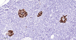 TIMP1 Antibody in Immunohistochemistry (Paraffin) (IHC (P))
