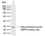 RBP4 Antibody in Western Blot (WB)