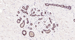 TROP2 Antibody in Immunohistochemistry (Paraffin) (IHC (P))