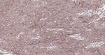 TROP2 Antibody in Immunohistochemistry (Paraffin) (IHC (P))
