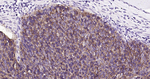 TROP2 Monoclonal Antibody (10C9)