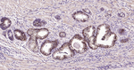 TROP2 Antibody in Immunohistochemistry (Paraffin) (IHC (P))