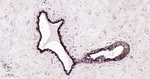 TROP2 Antibody in Immunohistochemistry (Paraffin) (IHC (P))