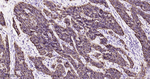 TROP2 Antibody in Immunohistochemistry (Paraffin) (IHC (P))