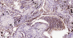 TROP2 Recombinant Rabbit Monoclonal Antibody (6F1)