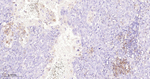 PD-L1 Antibody in Immunohistochemistry (Paraffin) (IHC (P))