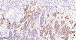 PD-L1 Antibody in Immunohistochemistry (Paraffin) (IHC (P))
